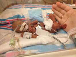 OUR MIRACLE SON