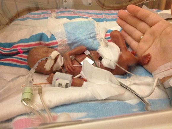 OUR MIRACLE SON